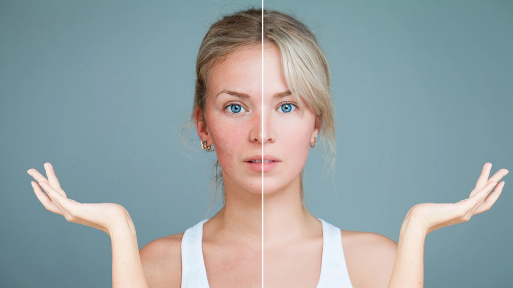 headshot image retouching